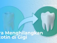 Cara Menghilangkan Nikotin di Gigi
